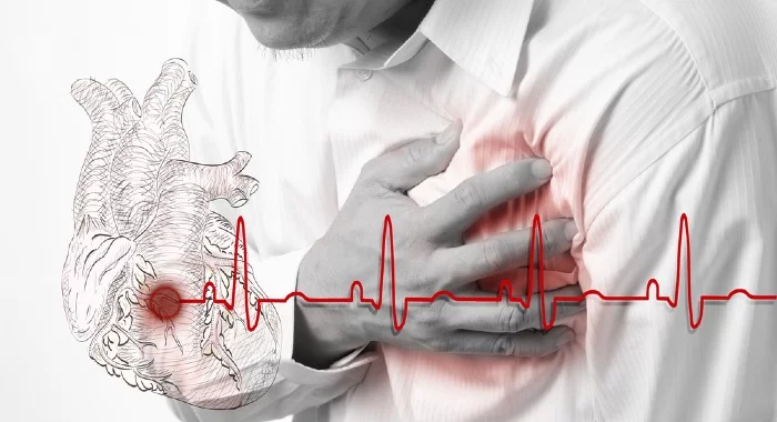 OSA can actually kill you through an heart attack, stroke or sudden death.